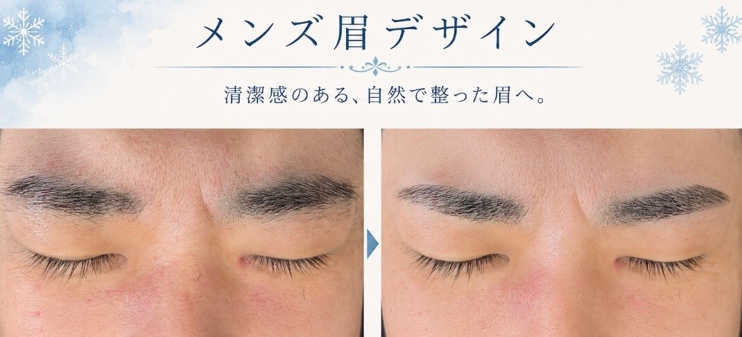 左右のまぶたのビフォーアフター写真、眉デザインと肌の赤み改善を示す。
